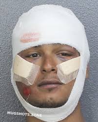 ALMEIDA ALEXANDER LOURES 03/16/2024