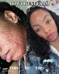 18 top Bagaimana Dengan Skincare Kadaluarsa ideas in 2024