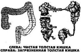 фото очищения кишечника