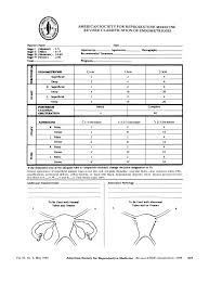 Moderate endometriosis (stage 3) involves multiple deep implants, small cysts on one or both ovaries, and the presence of flimsy adhesions. Classification Of Endometriosis