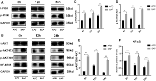 We did not find results for: Abdominal Paracentesis Drainage Attenuates Severe Acute Pancreatitis By Enhancing Cell Apoptosis Via Pi3k Akt Signaling Pathway Springerlink