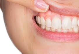 Place the toothbrush against the gums at a 45 degree angle. Grow Back Receding Gums With These Home Remedies 9to5hacks
