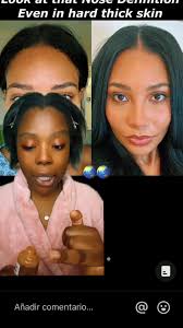 Chisme!!!! Operaciones antes y después #storytime #2024 #whitneyteresa...