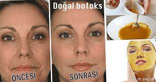 Botoks Etkisi Gosteren Super Karisimla Tanismaya Hazir Misiniz Yasimiz Ilerledikce Cildimizde Olusan Kirisikliklar Homemade Skin Care Skin Problems Skin Care
