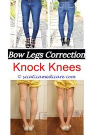 Bull Legged Bow Legged Knock Knees Leg Diseases