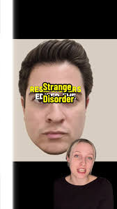 Rare Disorder Makes People Think They're Seeing 'demonic' Faces