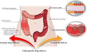 Plant cell walls make up much of the fibre that accumulates in your large intestines. Advances In Colon Targeted Nano Drug Delivery Systems Challenges And Solutions Springerlink