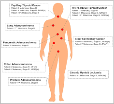 Image result for Primary Tumor Localization