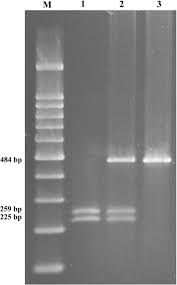 Detection of the Ile105Val (A to G transition) of GSTP1 by RFLP