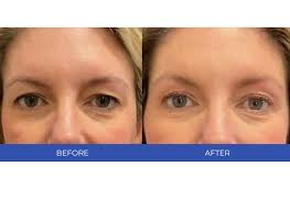 Treiber Dermatology Associates