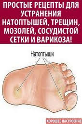 как избавиться от сосудистой сетки на ногах в домашних условиях Pin Na Doske Fitness Diet