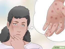 Symptoms of neurosyphilis can include: How To Recognize Syphilis Symptoms With Pictures Wikihow