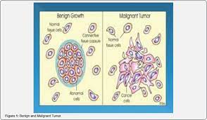 Explanations about what cancer is, how cancer cells differ from normal cells, and genetic changes that cause cancer to grow and spread. Cancer Therapy And Oncology International Journal Ctoij