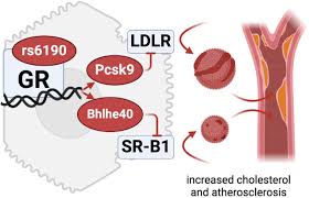The human glucocorticoid receptor variant rs6190 promotes blood cholesterol  and atherosclerosis