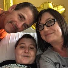 Anthony Wilson said his daughter, Kelsey, was left with over 15 percent of  burns