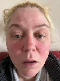 Hey everyone I got diagnosed with Fibromyalgia the first of the year after  dealing with pain for 14 years. All bloodwork has been normal so far but I  have been getting a