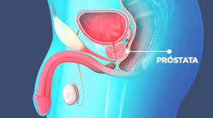 Reviews common tests for these conditions, as well as treatment side effects. A Prostata