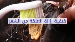 كيفية إزالة العلكة من الشعر youtube