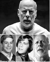 Family supports loved one with frontotemporal dementia