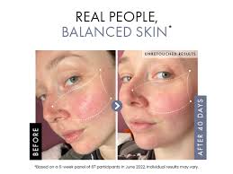 Amazon.com : DETOXIFYING Charcoal Blackhead Peel Off Face Mask