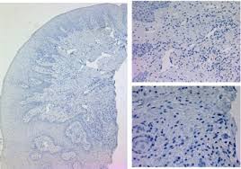 Residents have access to free tutoring through the academic success . Periodontal Disease From The Lenses Of Light Microscopy To The Specs Of Proteomics And Next Generation Sequencing Sciencedirect