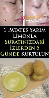 Gunes Lekesi Ve Cilt Lekeleri Icin Dogal Maske Lekeleri Lekesi Maske New Skin Blemishes Healthy Skin Tips Homemade Skin Care