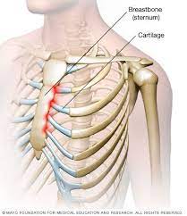 Pin On Ehlers Danlos Syndrome