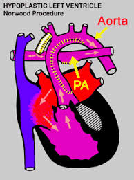 Pin On Maci Mae My Lil Bug Chd Awareness