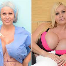 Mum-of-six with giant LLL breasts has 36th cosmetic surgery operation to  look like 'adult Barbie' - Irish Mirror Online