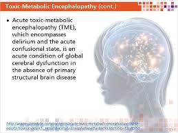 Toxic Encephalopathy Definition, Causes, Symptoms, Diagnosis, Treatment &  Prognosis