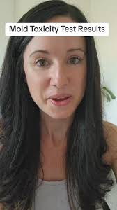 White pine needle is a great natural remedy for cough, congestion, and  mucus. #coughremedy #cough #congestion #naturalremedies #herbalremedies  #naturalmedicine