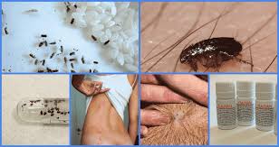 Si tienes chinches en tu casa, se recomienda el exterminio realizado por profesionales. Significa Matar Insectos Como Puedes Matar Las Chinches En Casa