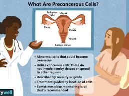 Pap and hpv tests help prevent cervical cancer. What It Means If You Have Precancerous Cells