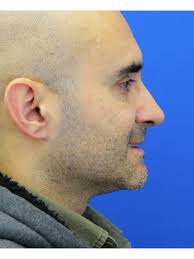 Cases in COSMETIC SURGICAL