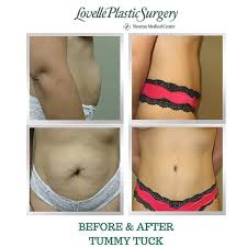 Pin On Plastic Surgery Medspa