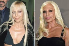 Want proof of the risks you could run if you either don't go to a certified plastic surgeon or aren't careful about what you ask for? Celebrities Who Went Too Far With Plastic Surgery Fillers Lipstick Alley