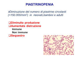 Neutropenia, linfocitosi relativa, diminuzioneo scomparsadeglieosinofili ñ leucocitosi (bambini) ñ anemia ñ. Dipartimento Di Pediatria Ppt Scaricare