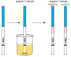 Meninas fiz um teste ontem (confirme semanas) e deu positivo. Como Pode A Menstruacao Atrasar E O Teste De Gravidez Dar Negativo Instituto Villamil