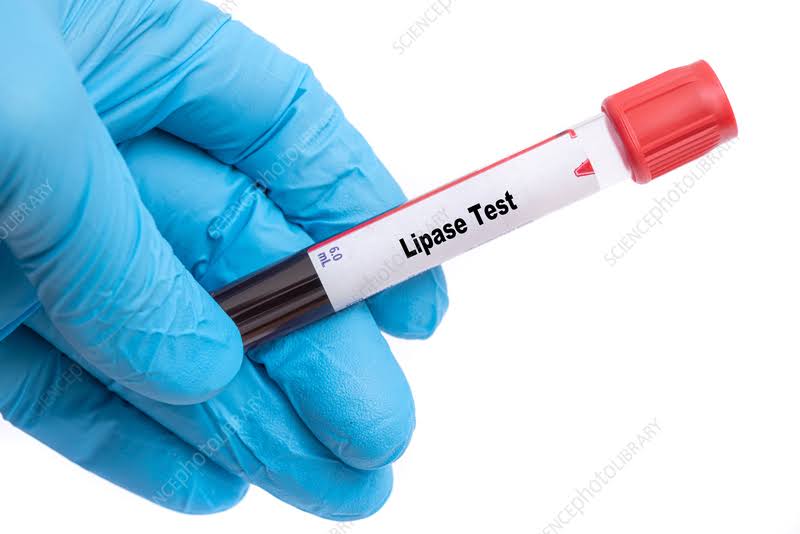 LIPASE product image