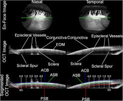 Image result for Sclera
