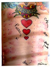 There are several reasons for this. Ask Surly Amy Allergy Shots Skepchick