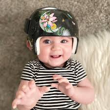 Cranial remolding helmets help to correct non symmetrical head shapes. This  pretty girl graduated from her helmet today. She did so fantastic! Thank  you mom for allowing us to share your pictures.