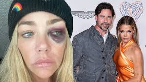 Denise Richards Accuses Ex Aaron Phypers of Abuse, Granted Restraining Order