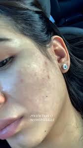 Muchas personitas me estuvieron pidiendo mi rutina de noche y aquí está ✨💕  disfruten del asmr también Dale line y contesta este video para obtener más  Información y obtener una valoración gratis ✨💕