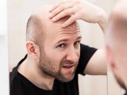 Best shampoos for hair loss. Hair Loss Treatment Medicines For Hair Fall And Hair Regrowth Times Of India