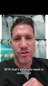 Indirect Pulp Capping with Mineral Trioxide Aggregate (MTA) in Endodontics