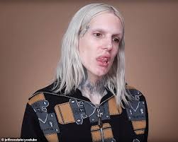 Will kirby in a youtube video on march 20 . Jeffree Star Reveals A Doctor Secretly Injected His Lips With Silicone Daily Mail Online