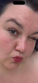 What skincare products are recommended for fine lines around eyes and  forehead?