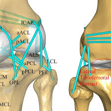 Pain above the knee cap (yellow). Schematic Of The Knee Model With Contact Conditions And 21 Ligament Download Scientific Diagram