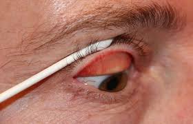 Das auge besteht aus dem augapfel und den dazugehörigen hilfseinrichtungen wie augenlider, wimpern und tränenorgane. Schmerzen Am Auge Auge Online